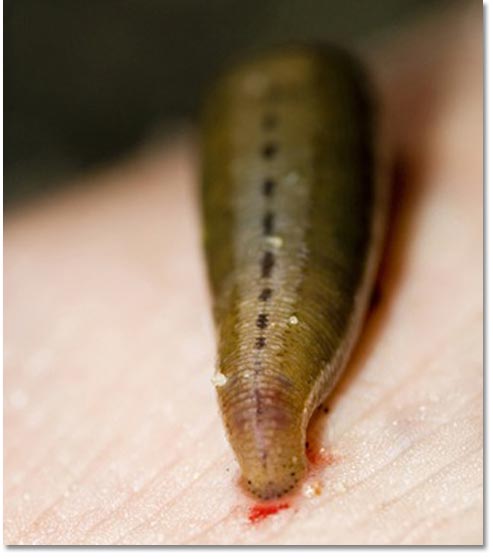 Removing Leeches and Treating Their Bites - DesertUSA